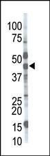 Anti-MGAT1 Rabbit Polyclonal Antibody (HRP (Horseradish Peroxidase))