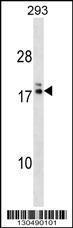 Anti-HIATL2 Rabbit Polyclonal Antibody (PE (Phycoerythrin))