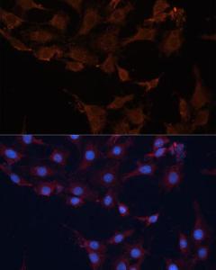 Immunofluorescence analysis of C6 cells using Anti-HMGCS1 Antibody (A9326) at a dilution of 1:100 (40x lens) DAPI was used to stain the cell nuclei (blue)