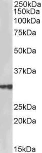 Anti-HSD17B3 Antibody (A85236) (2 µg/ml) staining of Human Testis lysate (35 µg protein in RIPA buffer). Primary incubation was 1 hour. Detected by chemiluminescence