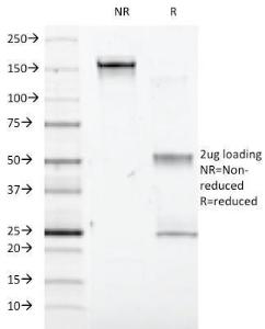 SDS-PAGE analysis of Anti-Interferon alpha 1 Antibody [2-48] under non-reduced and reduced conditions; showing intact IgG and intact heavy and light chains, respectively. SDS-PAGE analysis confirms the integrity and purity of the antibody.