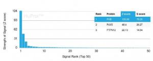 Analysis of protein array containing more than 19,000 full-length human proteins using Anti-Prohibitin Antibody [PHB/3228] Z-Score and S- Score