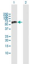 Anti-GBA Rabbit Polyclonal Antibody