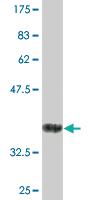 Anti-CD84 Mouse Monoclonal Antibody [clone: 3G10]