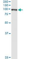 Anti-QARS Mouse Monoclonal Antibody [clone: 5F5]