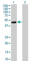 Anti-TSSK1 Mouse Monoclonal Antibody [clone: 4F12]