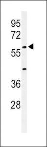 Anti-AMH Rabbit Polyclonal Antibody (HRP (Horseradish Peroxidase))