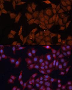 Immunofluorescence analysis of HeLa cells using Anti-HMGCS1 Antibody (A9326) at a dilution of 1:100 (40x lens) DAPI was used to stain the cell nuclei (blue)