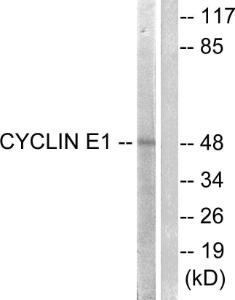 Western blot analysis of lysates from HeLa cells, treated with Paclitaxel 1uM 60' using Anti-Cyclin E1 Antibody. The right hand lane represents a negative control, where the antibody is blocked by the immunising peptide