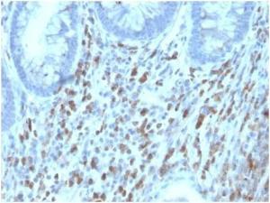 Immunohistochemical analysis of formalin-fixed, paraffin-embedded human adrenal gland tissue using Anti-CD130 (gp130) Antibody [IL6ST/4101]