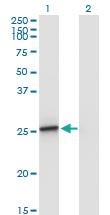 Anti-AMELX Mouse Monoclonal Antibody [clone: 5B2]