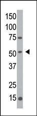 Anti-MGAT1 Rabbit Polyclonal Antibody (AP (Alkaline Phosphatase))