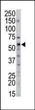 Anti-SPTLC2 Rabbit Polyclonal Antibody