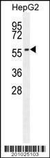 Anti-ADCK3 Mouse Monoclonal Antibody (AP (Alkaline Phosphatase)) [clone: 216CT7.5.1]