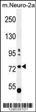 Anti-LRWD1 Rabbit Polyclonal Antibody (FITC (Fluorescein Isothiocyanate))