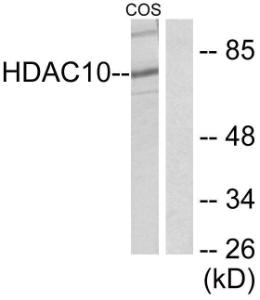 Western blot analysis of lysates from COS7 cells using Anti-HDAC10 Antibody. The right hand lane represents a negative control, where the antibody is blocked by the immunising peptide