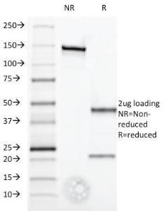 SDS-PAGE analysis of Anti-Interferon alpha 1 Antibody [2-52] under non-reduced and reduced conditions; showing intact IgG and intact heavy and light chains, respectively SDS-PAGE analysis confirms the integrity and purity of the antibody