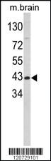 Anti-GOT1 Rabbit Polyclonal Antibody