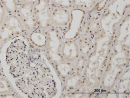 Anti-MSI1 Mouse Monoclonal Antibody [clone: 1B11]