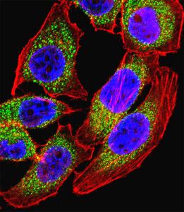 Anti-NFATC4 Rabbit Polyclonal Antibody (AP (Alkaline Phosphatase))