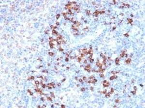 Immunohistochemical analysis of formalin-fixed, paraffin-embedded human lymph node using Anti-ZFP64 Antibody [PCRP-ZFP64-1 h2]