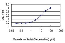 Anti-QARS Mouse Monoclonal Antibody [clone: 5F5]