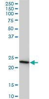 Anti-RRAS2 Mouse Monoclonal Antibody [clone: 2D3-4B8]