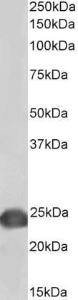 Anti-PARK7 antibody