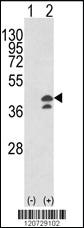 Anti-GOT1 Rabbit Polyclonal Antibody