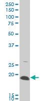 Anti-AMELX Mouse Monoclonal Antibody [clone: 3B5]