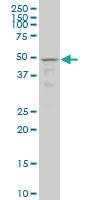 Anti-TSSK1 Mouse Monoclonal Antibody [clone: 2E8]