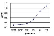 Anti-RELT Antibody Pair