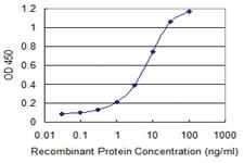 Anti-QDPR Mouse Monoclonal Antibody [clone: 2D4-1D3]