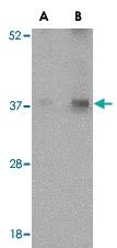 Anti-EMD Rabbit Polyclonal Antibody