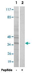 Anti-BNIP2 Rabbit Polyclonal Antibody