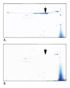 Albumin depletion kit, Pierce™