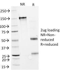 SDS-PAGE analysis of Anti-Interferon alpha 2 Antibody [N27] under non-reduced and reduced conditions; showing intact IgG and intact heavy and light chains, respectively. SDS-PAGE analysis confirms the integrity and purity of the Antibody