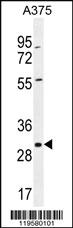 Anti-COPE Rabbit Polyclonal Antibody [clone: 193CT15.2.2]