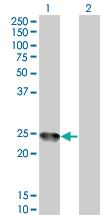 Anti-AMELX Mouse Monoclonal Antibody [clone: 6G3]