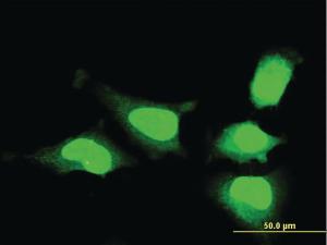 Anti-MSI1 Mouse Monoclonal Antibody [clone: 1B11]