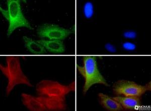 Anti-TRPM8 Rabbit Polyclonal Antibody