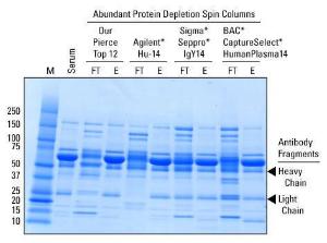 Abundant protein depletion spin columns, Top 2 and Top 12, Pierce™