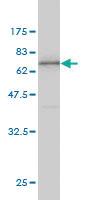 Anti-ANXA2 Mouse Monoclonal Antibody [clone: 1G7]