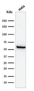 Western blot analysis of HeLa cell lysate using Anti-HSP60 Antibody [GROEL/730]