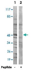 Anti-GCNT7 Rabbit Polyclonal Antibody