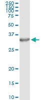 Anti-PSME2 Antibody Pair