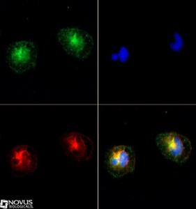 Anti-TRPM2 Rabbit Polyclonal Antibody