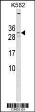 Anti-KCNE4 Rabbit Polyclonal Antibody