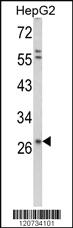 Anti-SDC1 Rabbit Polyclonal Antibody