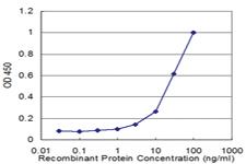 Anti-GBA Mouse Monoclonal Antibody [clone: 2H4]